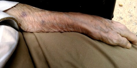 My mother's arm. Fairfax Nursing Center, Virginia. Sunday, 22 June 2014.